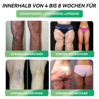 𝑶𝒇𝒇𝒊𝒛𝒊𝒆𝒍𝒍 𝒆𝒎𝒑𝒇𝒐𝒉𝒍𝒆𝒏 👩‍⚕️ 𝒗𝒐𝒏 𝑫𝒆𝒖𝒕𝒔𝒄𝒉𝒍𝒂𝒏𝒅 𝐅𝐥𝐚𝐠𝐠𝐬𝐡𝐢𝐩-𝐒𝐭𝐨𝐫𝐞 𝐃𝐢𝐫𝐞𝐤𝐭𝐯𝐞𝐫𝐤𝐚𝐮𝐟 | 🏆𝐋𝐄𝐑𝐂𝐄𝐀® 𝐆𝑳𝐏-𝟏 𝐌𝐞𝐭𝐚𝐛𝐨𝐥𝐢𝐬𝐜𝐡𝐞 𝐁𝐚𝐥𝐚𝐧𝐜𝐞 𝐓𝐫𝐢𝐧𝐤𝐚𝐦𝐩𝐮𝐥𝐥𝐞: 𝐅𝐞𝐭𝐭𝐥𝐞𝐢𝐛𝐢𝐠𝐤𝐞𝐢𝐭, 𝐇𝐞𝐫𝐳- 𝐊𝐫𝐞𝐢𝐬𝐥𝐚𝐮𝐟-𝐄𝐫𝐤𝐫𝐚𝐧𝐤𝐮𝐧𝐠𝐞𝐧, 𝐃𝐢𝐚𝐛𝐞𝐭𝐞𝐬, 𝐒𝐜𝐡𝐥𝐚𝐟𝐚𝐩𝐧𝐨𝐞-𝐒𝐲𝐧𝐝𝐫𝐨𝐦, 𝐆𝐞𝐥𝐞𝐧𝐤𝐩𝐫𝐨𝐛𝐥𝐞𝐦𝐞 usw💞